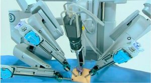 Лечение рака в Израиле роботом Да Винчи